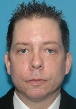 After Image: Eye Lift (Blepharoplasty): Case 12 - front