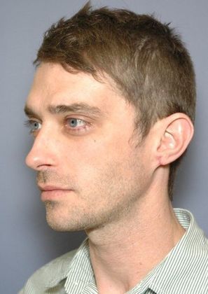 After Image: Otoplasty: Case 3 - left-front-oblique